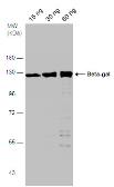 Anti-Beta-gal antibody used in Western Blot (WB). GTX132107